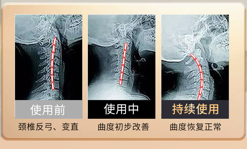 和正 和正颈椎按摩枕 HZ-Z-2