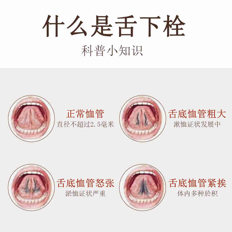 珂愈舌下溶栓喷剂草本植物精华萃取温和不刺激化瘀舌下溶栓液