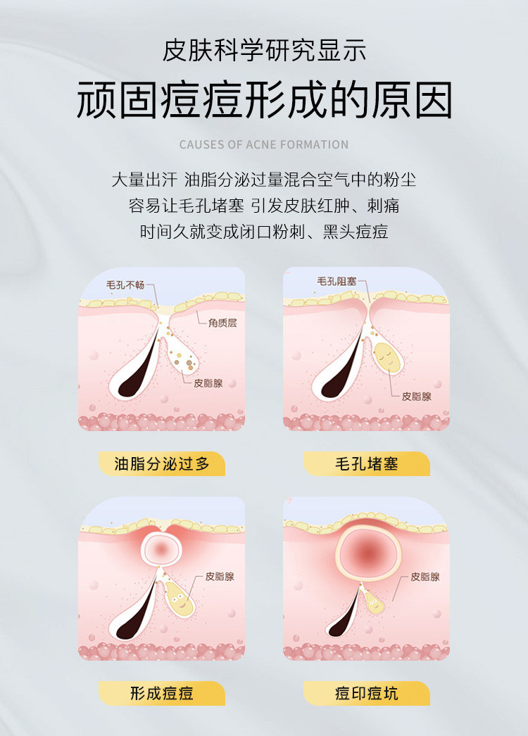 丽颜肌皮傲宁祛痘膏净痘控油淡化痘印修护痘肌男女通用
