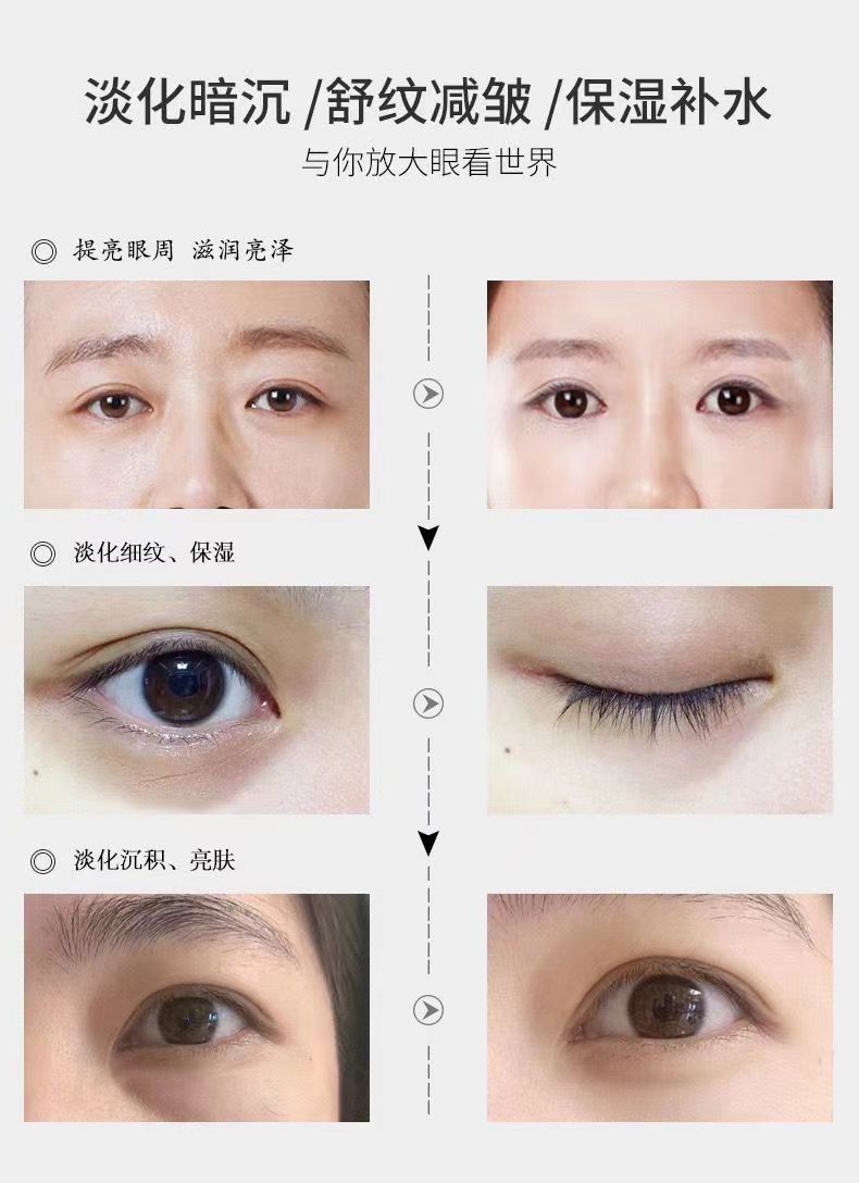 仁和匠心类蛇毒肽眼霜