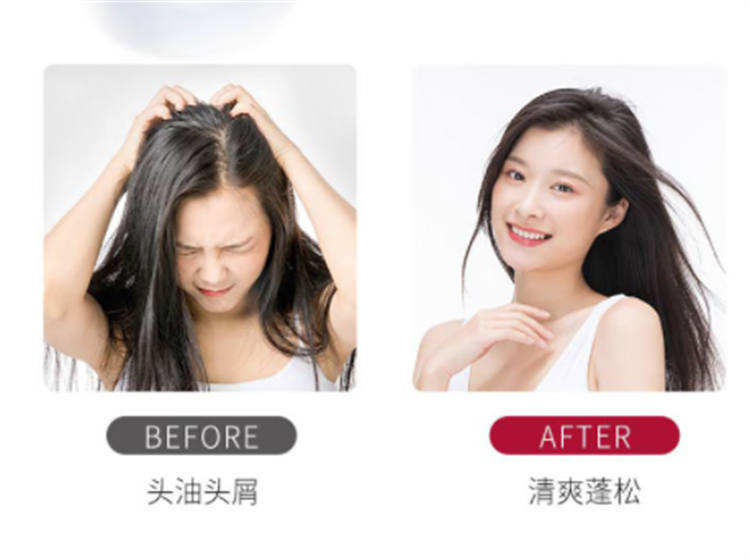 舒蕾轻润丝滑护发素改善毛糙修护敏感油头润发乳-430g