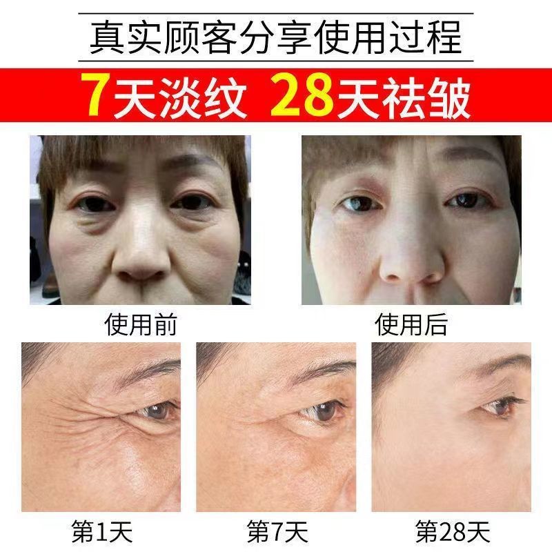 仁和匠心类蛇毒肽眼霜