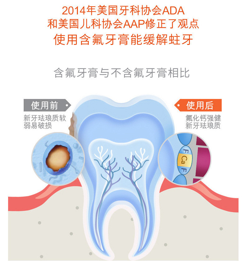 艾美适儿童防蛀牙膏含氟去牙渍牙黄清口气水果牙膏