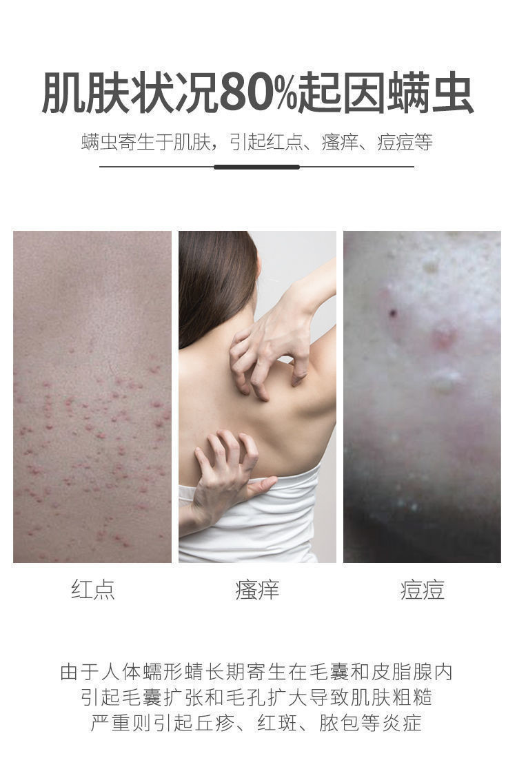 仁和除螨皂祛痘洁面净螨控油去角质手工香皂