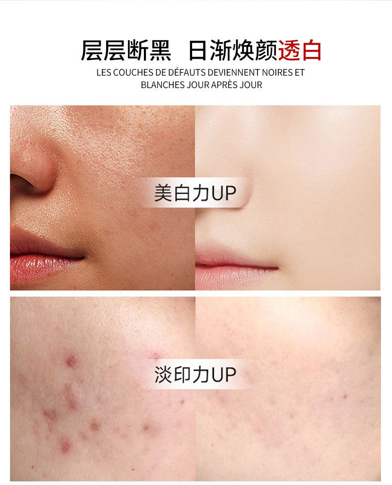 QOZO日出倾城美白淡斑精华液