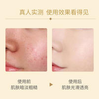 卡蜜妍富勒烯多效冻干粉修护套盒