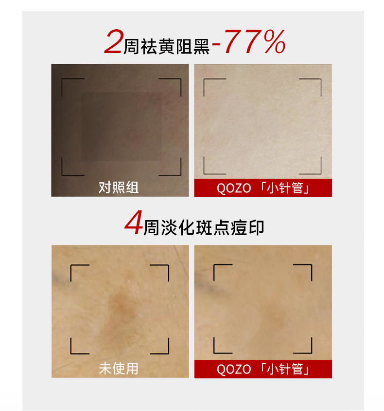 QOZO日出倾城美白淡斑精华液
