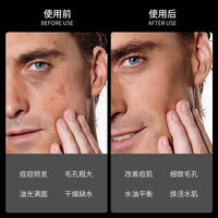 洁芙泉男士矿物泥控油三件套深层洁面控油保湿洗面奶水乳护肤三件套