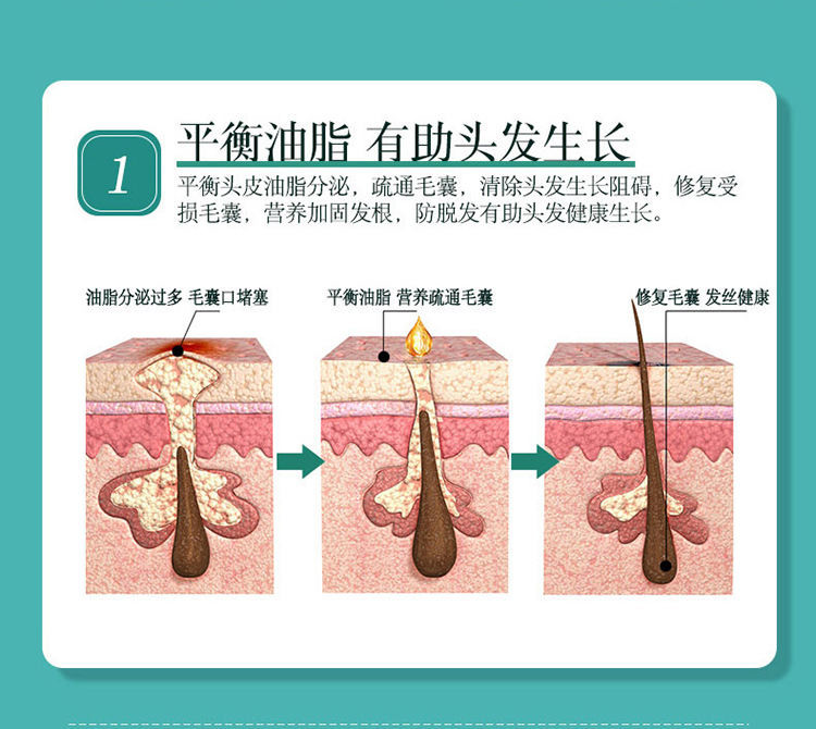 章光101经典防脱洗发液植物草本滋养固发洗头膏428g